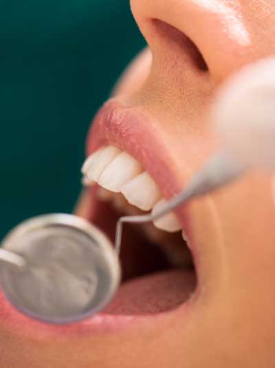 Periodontal Maintenance in Louisville, KY